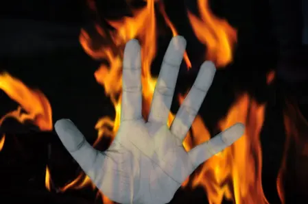 Odisha self-immolation attempt: College student’s condition still critical